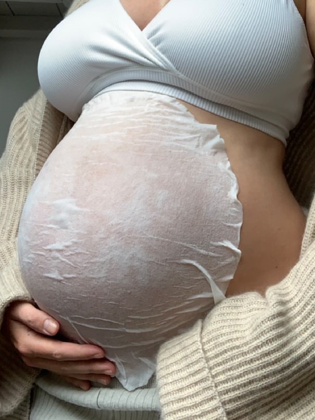 The Pregnancy Stretch Mark Duo